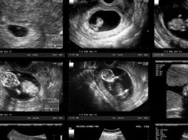 南昌市试管婴儿医院排名比较好，南昌市试管婴儿成功率医院排名