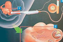 萍乡市妇幼保健院做三代试管婴儿的成功率有多少？附试管助孕详细费用汇总