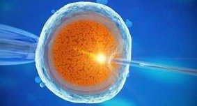 美国做三代试管婴儿费用要多少钱？