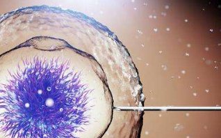 美国试管婴儿医院名单公开，CCRH／LEGACY皆榜上有名