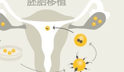 三代试管技术费用一览，全面了解价格详情